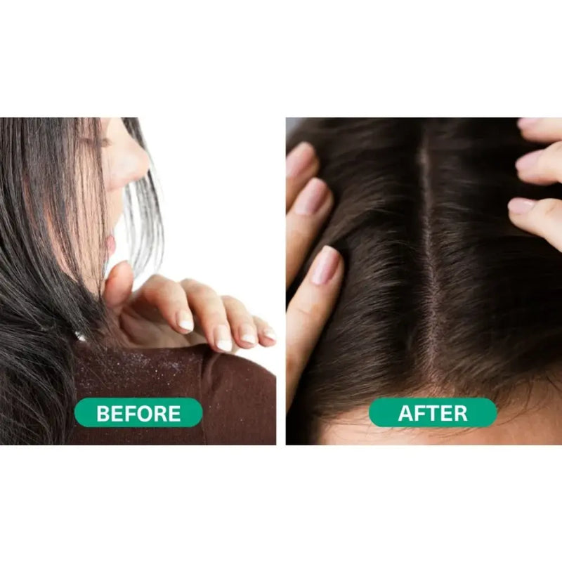 Hemptouch CBD Revive Scalp Treatment 50.00 Milliliter extra image